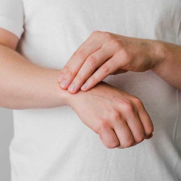 Некоторые примеры предметов и веществ, вызывающих аллергию на химию на руках: