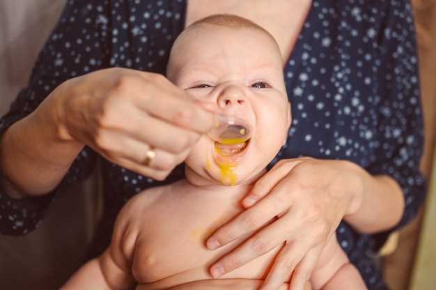 Что такое желтушка у новорожденного