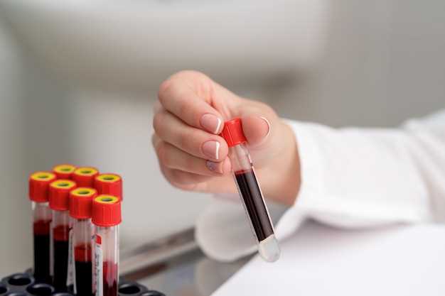 Изучение состава крови как инструмент диагностики