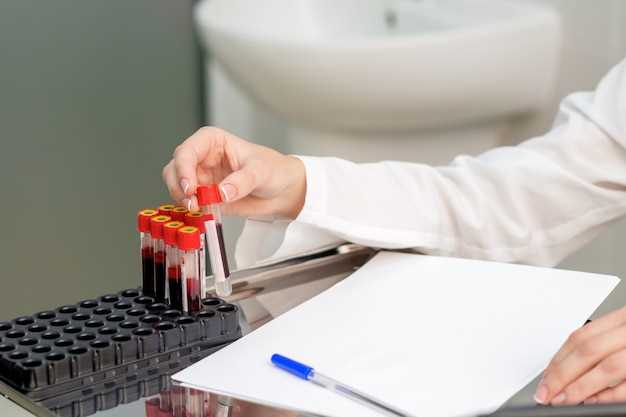 Общий анализ крови: что можно выявить?