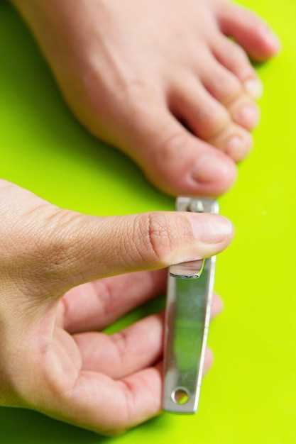 Недостаток витаминов и микроэлементов в организме и его влияние на здоровье ногтей