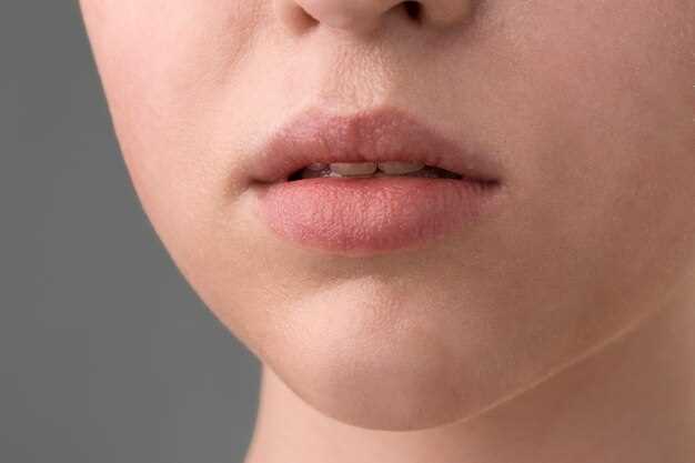 Методы лечения герпеса на губе